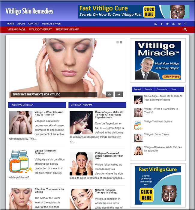 vitiligo skin remedy plr website