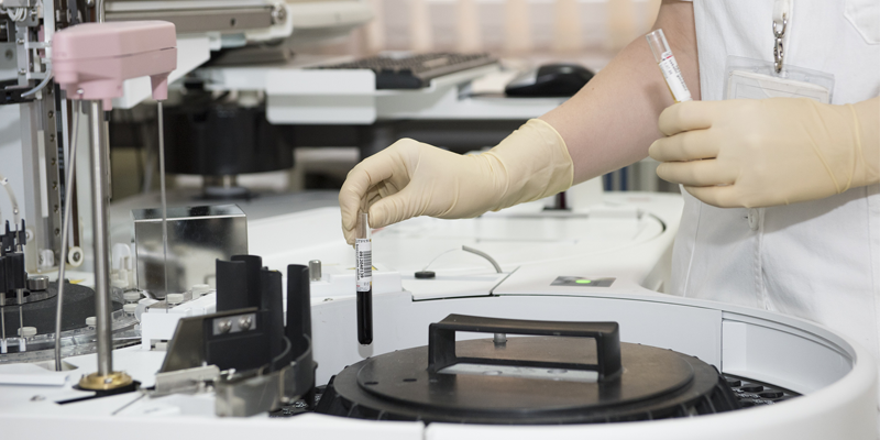 healthy prostate cmni template