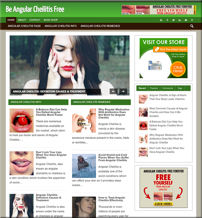 Angular Cheilitis PLR Site angular cheilitis plr site