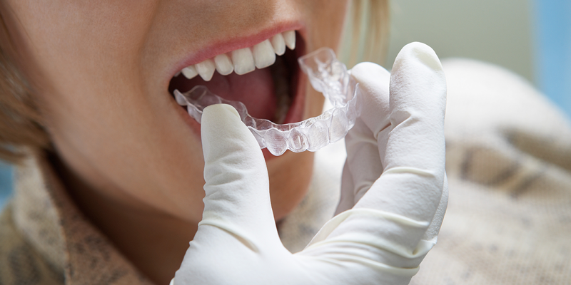 bruxism dyol niche blog