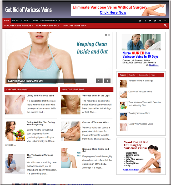 Varicose Veins Niche PLR Website varicose veins niche plr website